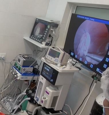Laparoscopic Spaying